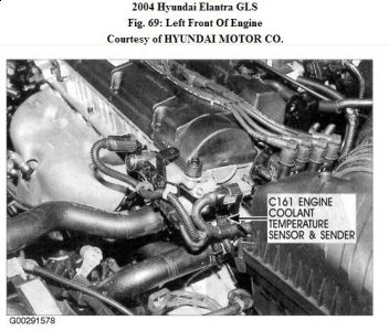 https://images.2carpros.com/forum/automotive_pictures/192750_ECT04Elentra_1.jpg