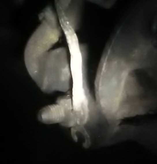 Attached Media